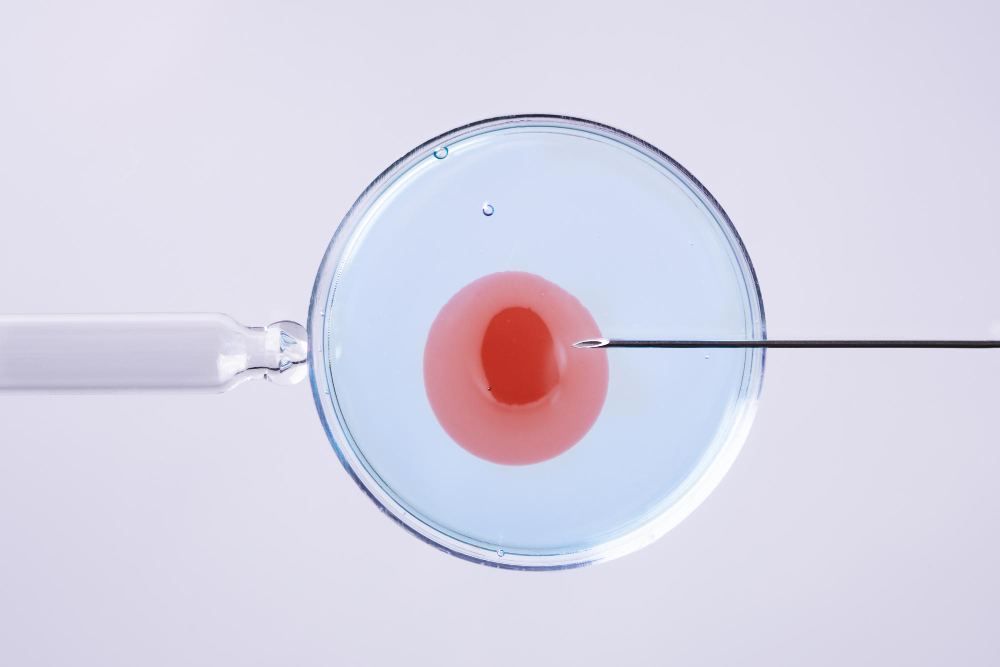 Is ICSI Better Than IVF